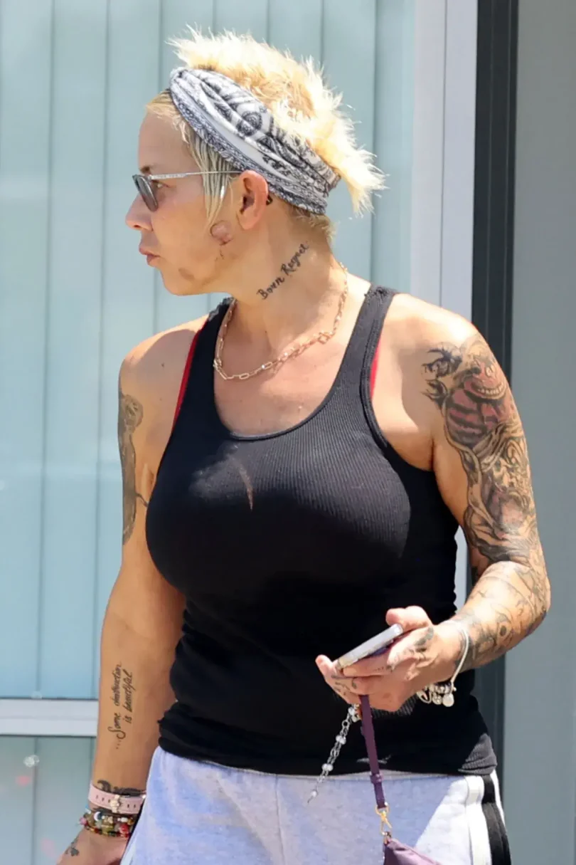 Kim Mathers Spotted with Facial Injury After Ex Eminem Mentions Her on New Album